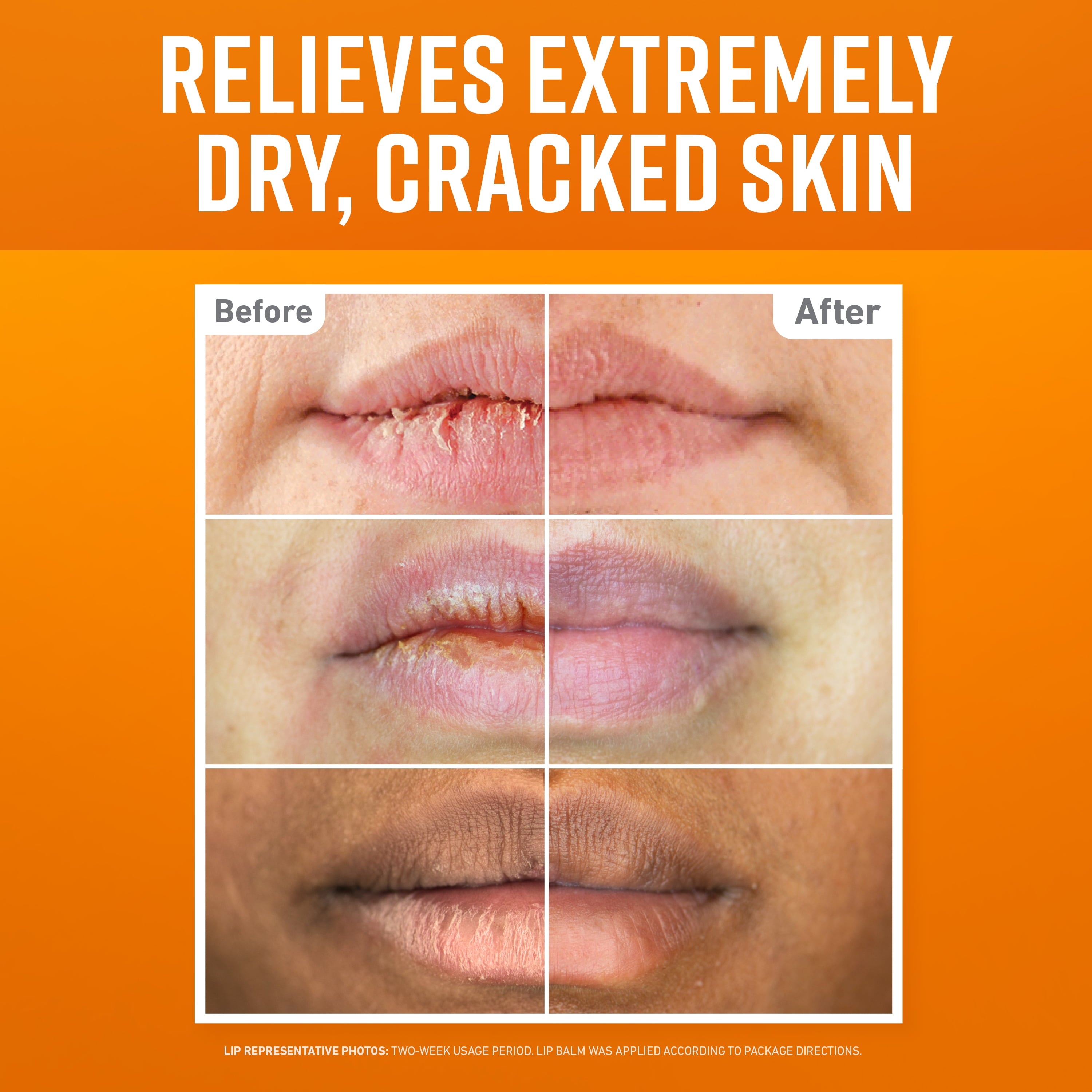 Lip Repair Variety Pack: Cooling, SPF, Original - Three 0.15Oz Lip Balm Sticks