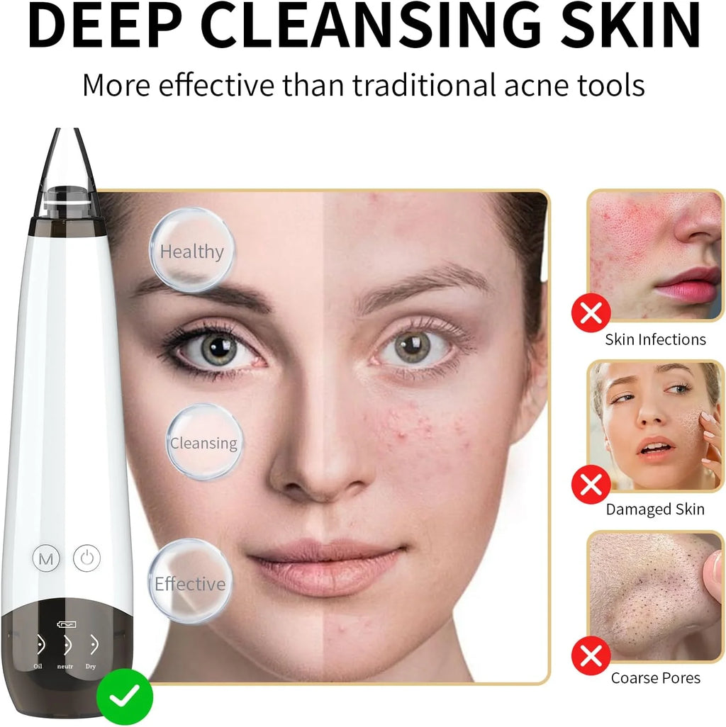 Advanced Blackhead Remover Vacuum - USB Rechargeable Pore Cleaner with 5 Probes for Flawless Skin